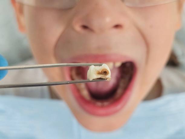 Best Mobile Emergency Dentist in Ashwaubenon, WI
